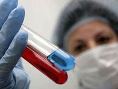 全自动草莓视频IOS在线下载有哪些检测方法？