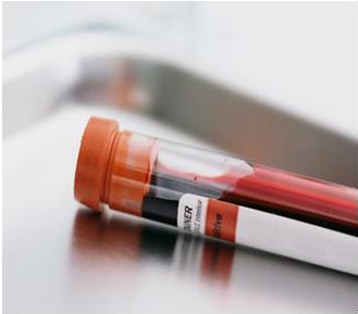 用血液检测草莓视频IOS在线下载器